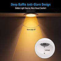 TORCHSTAR 4-Inch Deep Anti-Glare LED Recessed Light with J-Box - 15W - 5CCT White